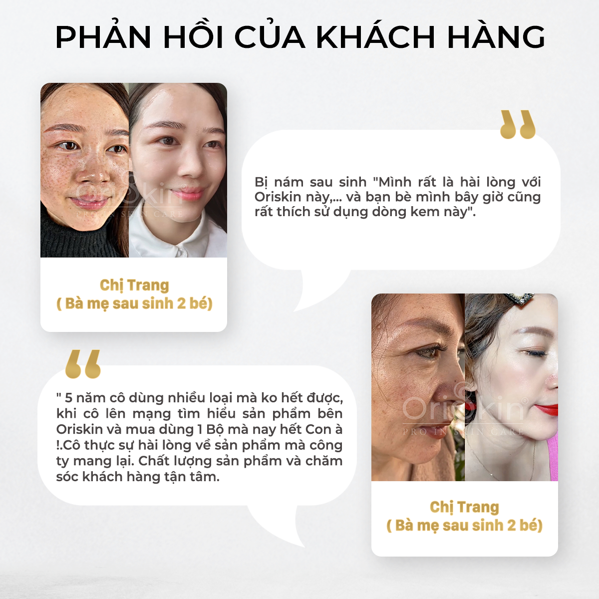 Kem Dưỡng Trắng Da Mờ Nám Tàn Nhang Melasma White Perfect Cream, Giảm Thâm Sạm Sau Mụn, Phù Hợp Với Cả Da Nam Và Nữ