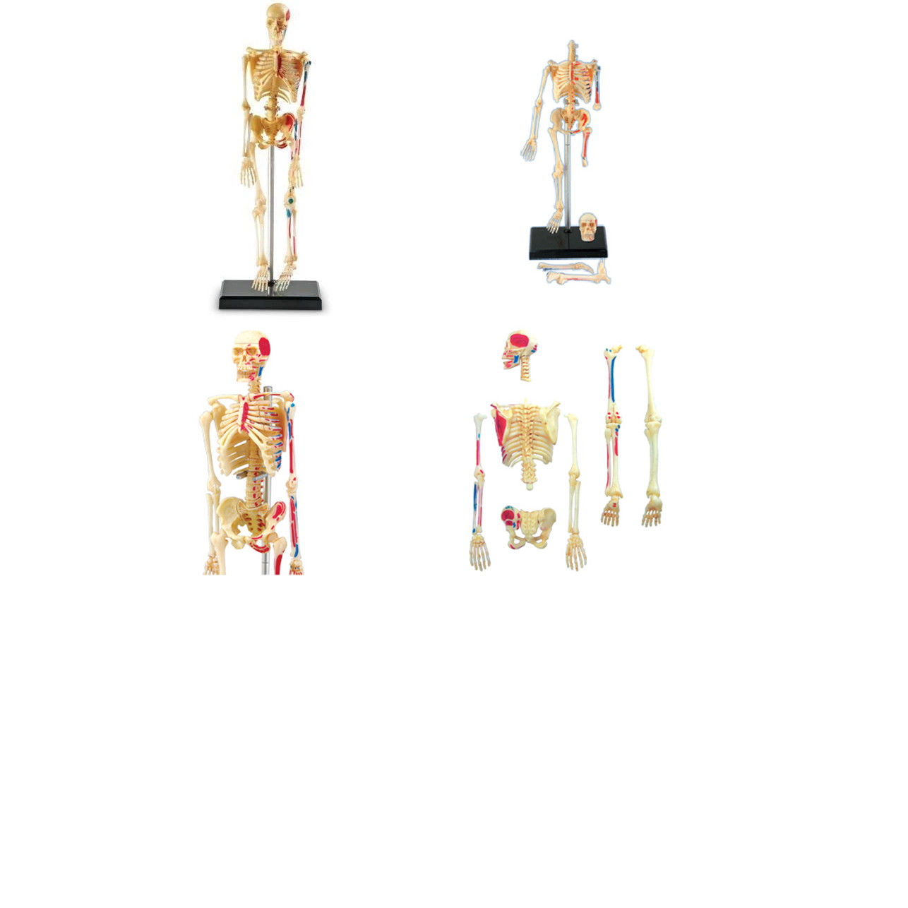 Mô hình phẫu thuật  Lắp ráp bộ xương