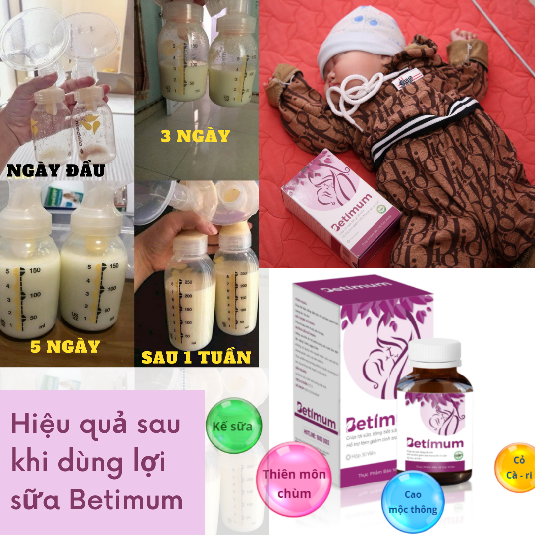 Hộp 30 viên uống lợi sữa Betimum