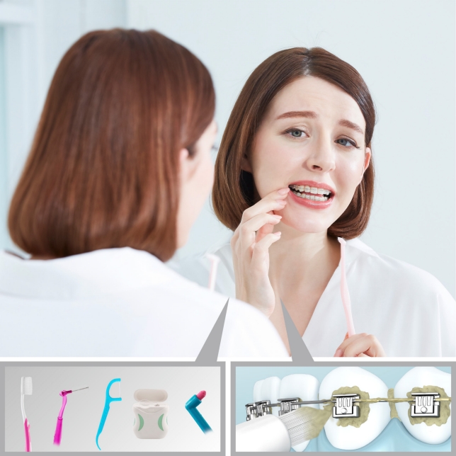 Chăm sóc răng miệng là một việc bất tiện cho bệnh nhân chỉnh nha