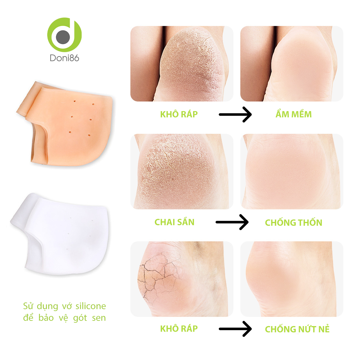 Vớ bọc gót chân silicone chống nứt nẻ chống bong tróc da, bảo vệ gót - Doni - DOPK68