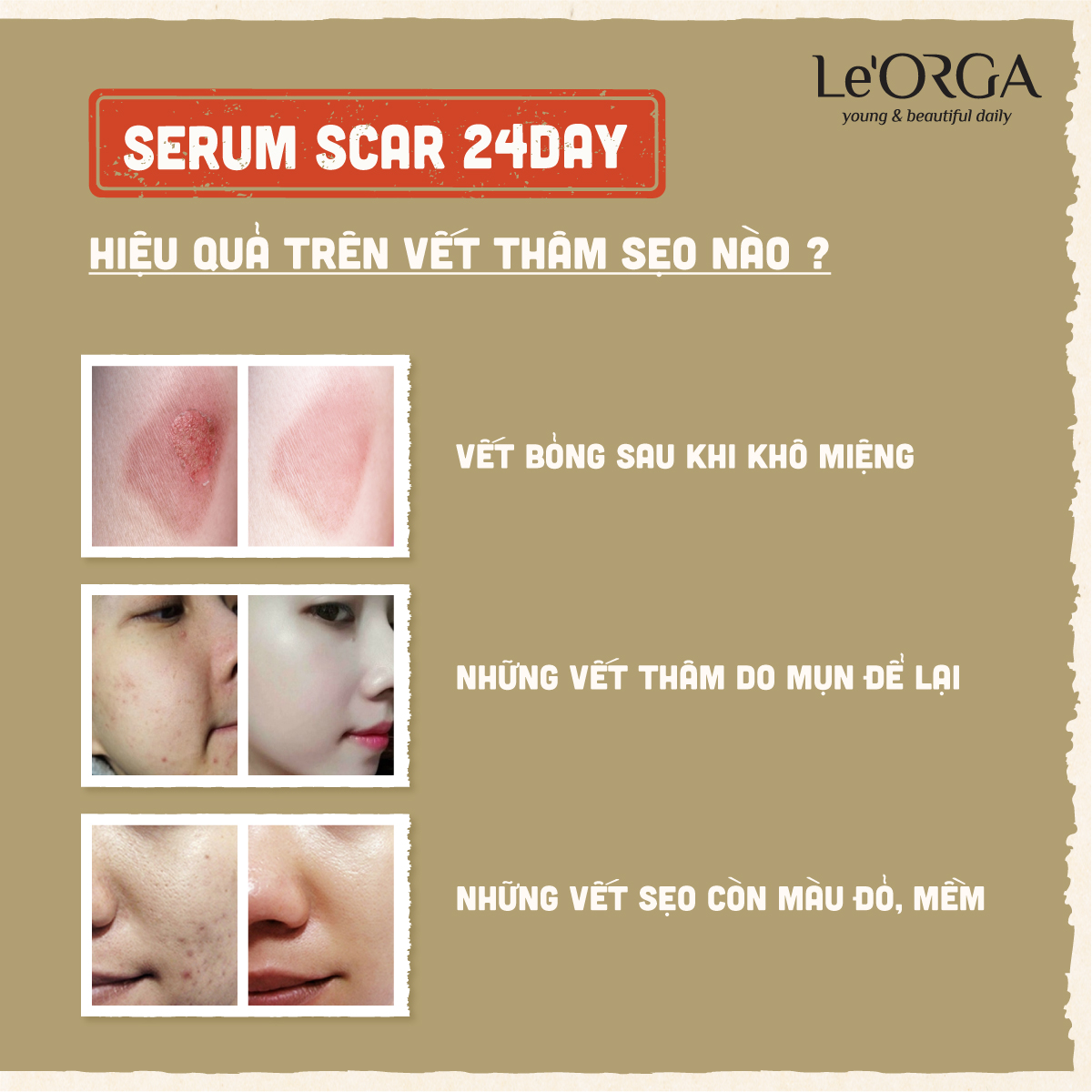 Serum Làm Mờ Thâm Sẹo và Sáng Da - LE’ORGA SCAR 24DAY 30 ml