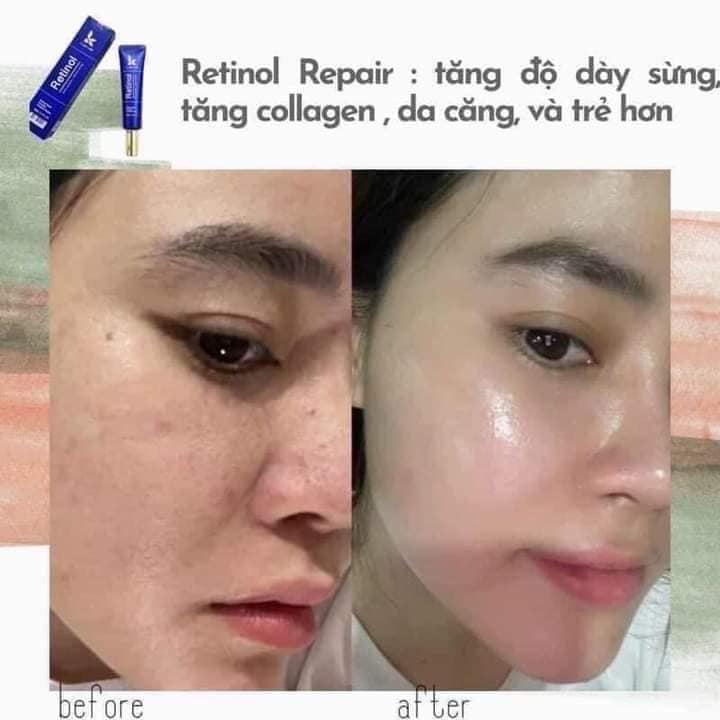 Kem dưỡng retinol K Lady Care Hàn Quốc 30ml ( không xuất hóa đơn đỏ )