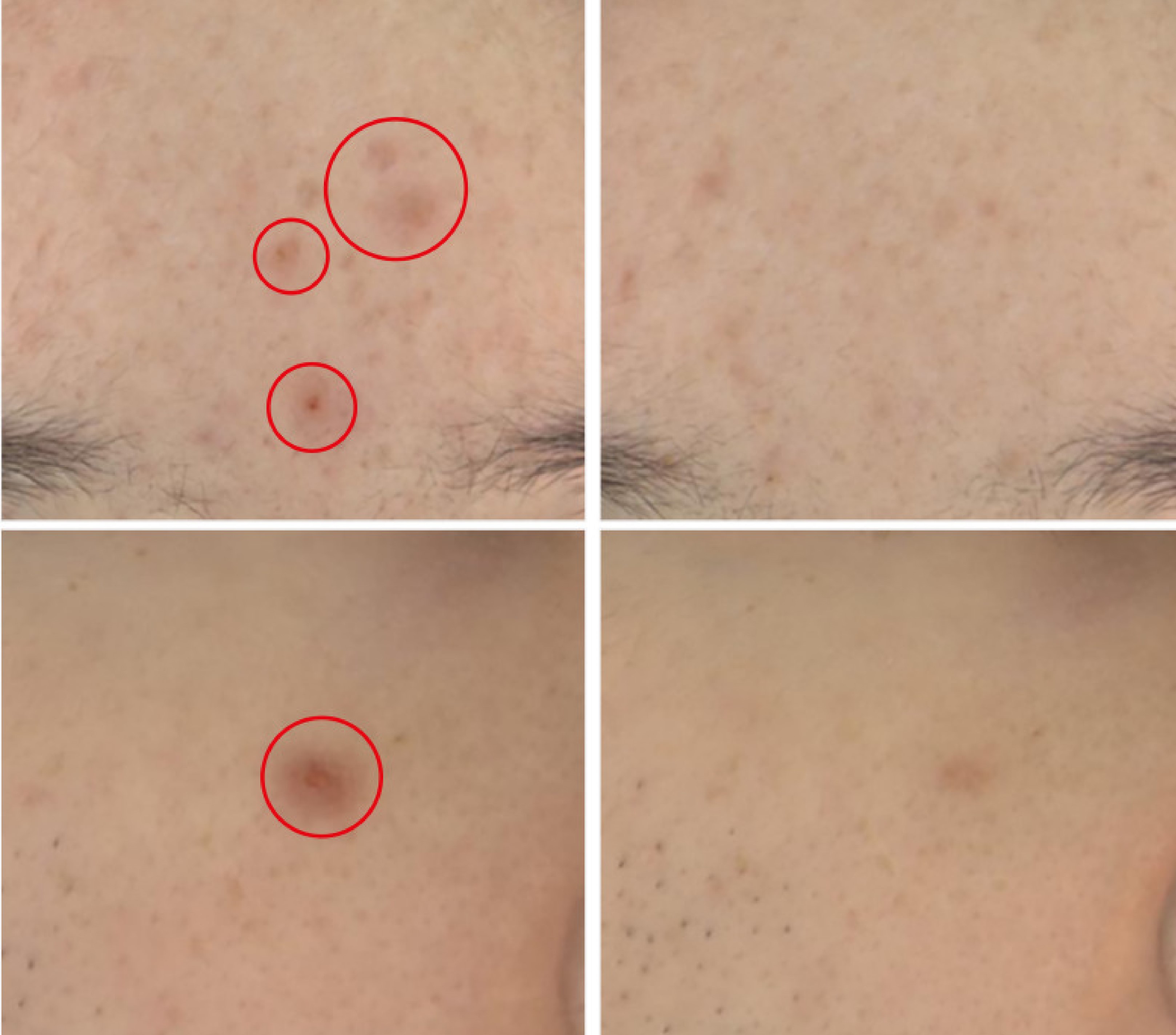 Kem dưỡng cho da mụn AC PLUS CLEARING CREAM