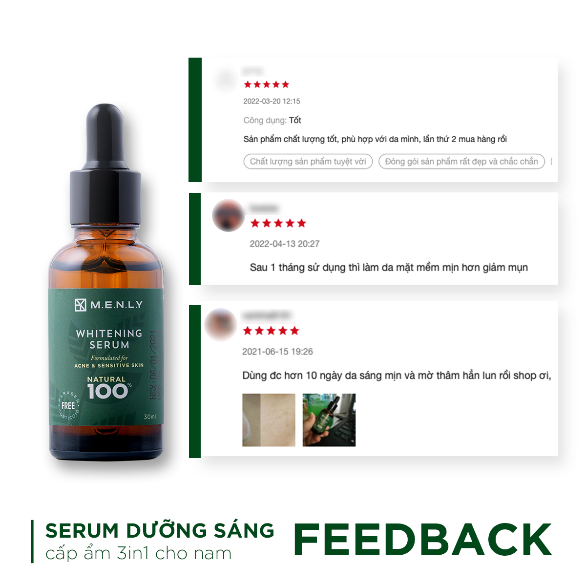 Serum dưỡng ẩm, trắng da cho nam Menly - dùng cho da nhạy cảm 30ml
