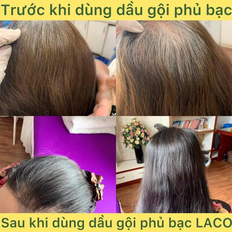 Dầu Gội Phủ Bạc chính hãng Laco Black Hair 200ml giúp tóc đen tự tin sau 9 phút