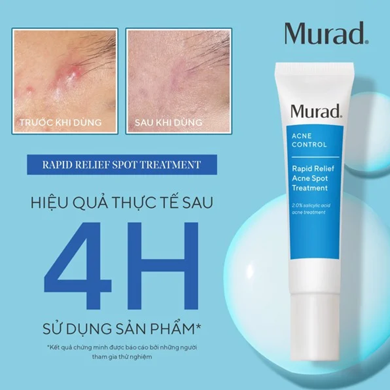 Gel giảm mụn cấp tốc Murad Rapid Relief Acne Spot Treatment 15ml