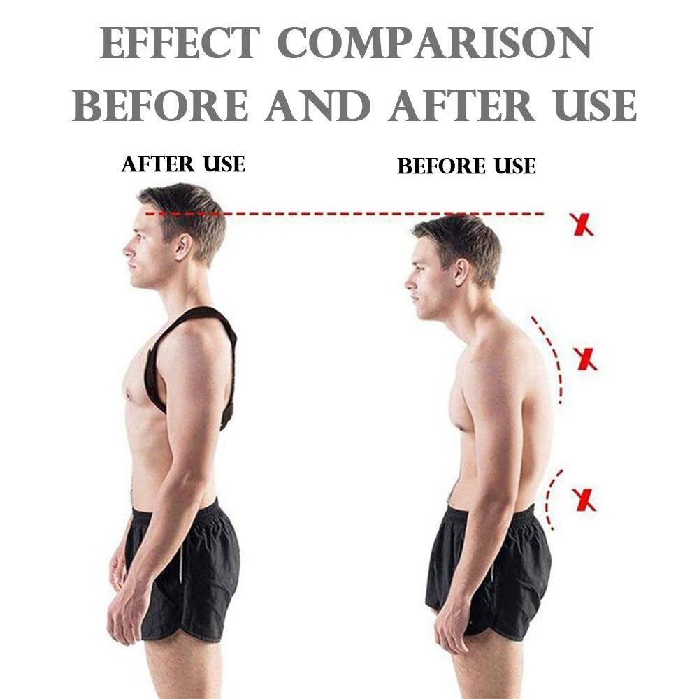 High Quality Adjustable Brace Support Belt Adjustable Back Posture Corrector Clavicle Spine Back Shoulder Lumbar Posture Correct