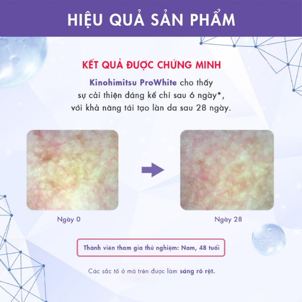 Bột uống Glutathone Giúp Trắng Da Và Gan Khoẻ Mạnh kinohimitsu Prowhite Hộp 30 gói