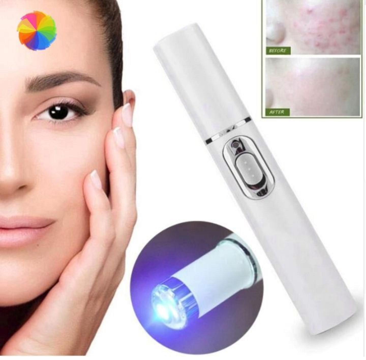 1 BÚT MÁY ÁNH SÁNG XANH XÓA TRỊ MỤN SẸO TRÊN DA HIỆU QUẢ AN TOÀN TIỆN DỤNG HÀNG CHẤT LƯỢNG