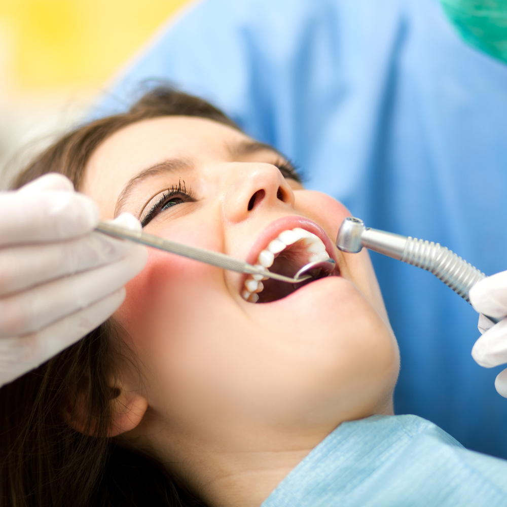 Đính Đá Răng Thẩm Mỹ - Nha Khoa Gia Hân