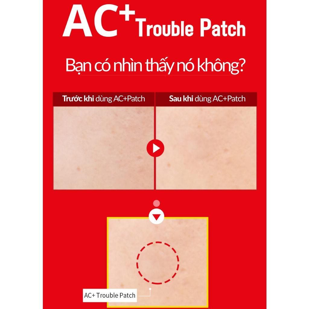 Miếng dán mụn mỏng nhẹ trong suốt AC+ TROUBLE PATCH giải pháp cấp cứu cho da bị mụn