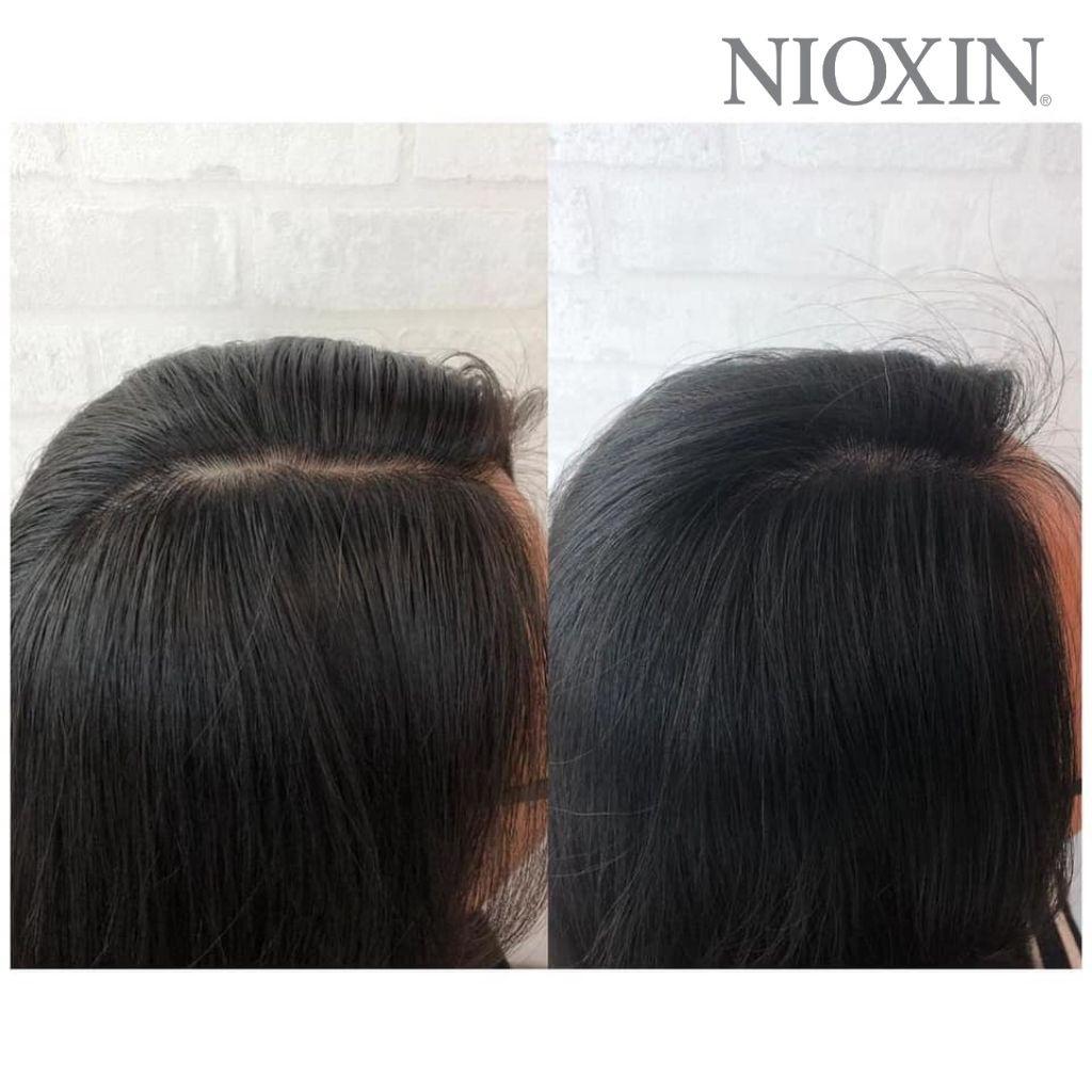 Bộ Chăm Sóc Tóc NIOXIN 1 Dành Cho Tóc Tự Nhiên, Thưa Mỏng Và Rụng Nhẹ Natural Hair Light Thinning