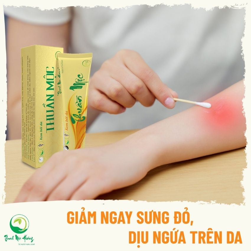 Kem bôi da Thuần Mộc hỗ trợ điều trị viêm da cơ địa, viêm da dị ứng, nấm ngứa, vẩy nến, rạn da, chàm sữa, hăm da trẻ sơ sinh, làm dịu da cho bé