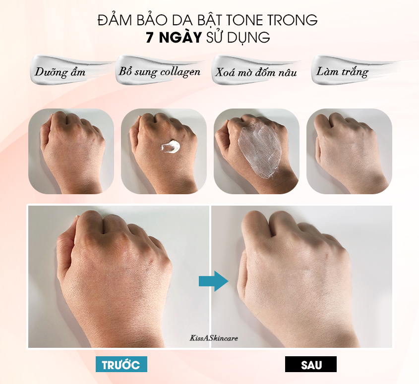 Kem Dưỡng Trắng Da Collagen KissA 15g