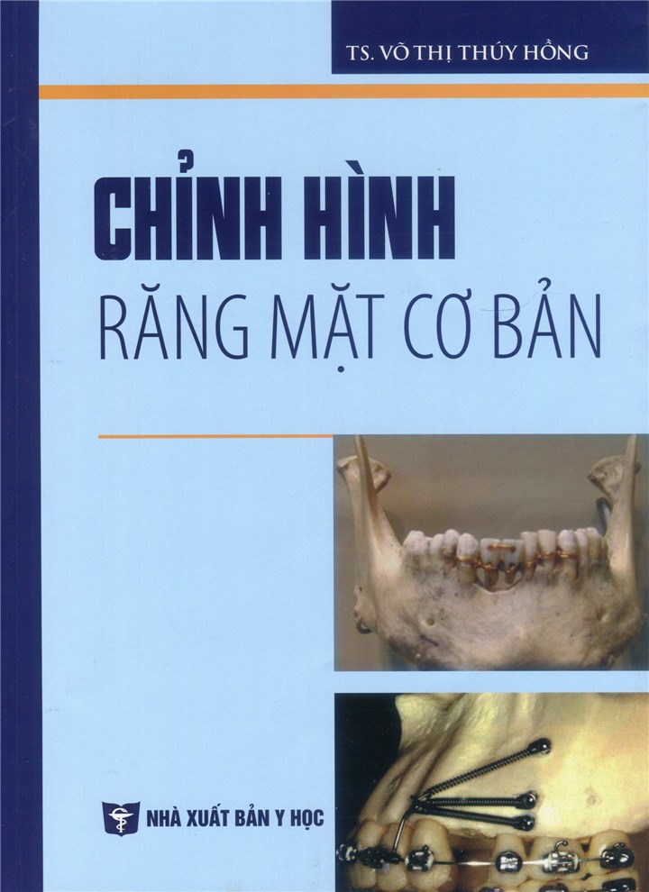 BENITO - Chỉnh hình răng mặt cơ bản