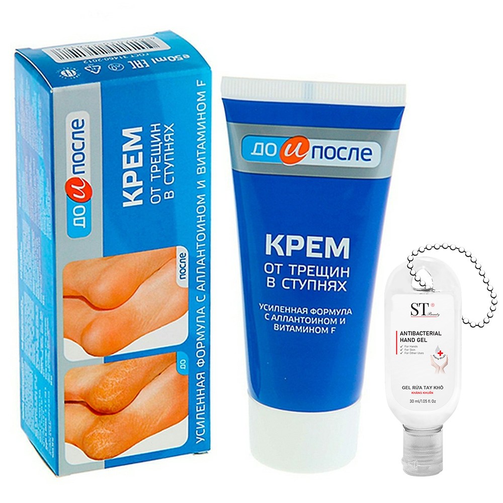 Kem Ngừa Nứt Gót Chân KPEM Dưỡng Ẩm và Làm Mềm 50ml NGA. Tặng Gel Móc Khóa 30ml