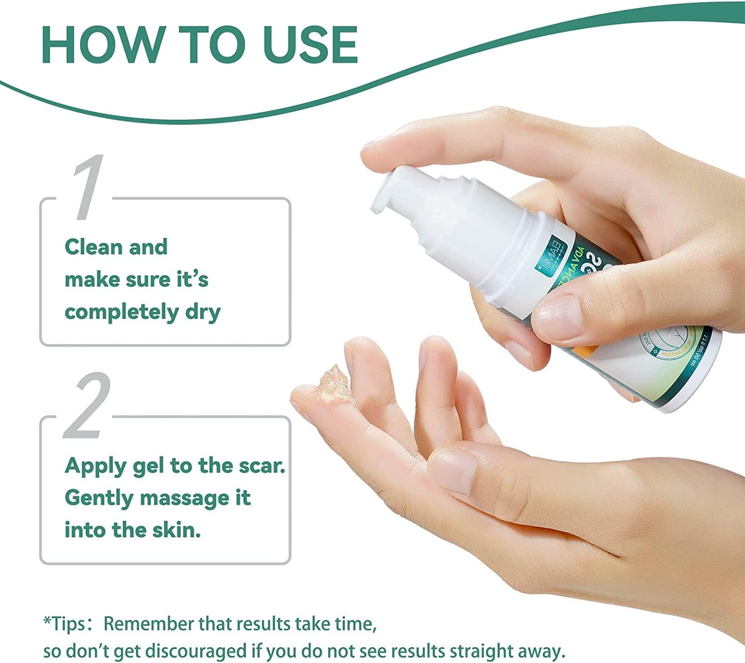Silicone Scar Gel - Kem sẹo nâng cao, làm mềm và làm phẳng các vết sẹo cũ và mới do mổ lấy thai, phẫu thuật, mụn trứng cá, vết rạn da 50ml