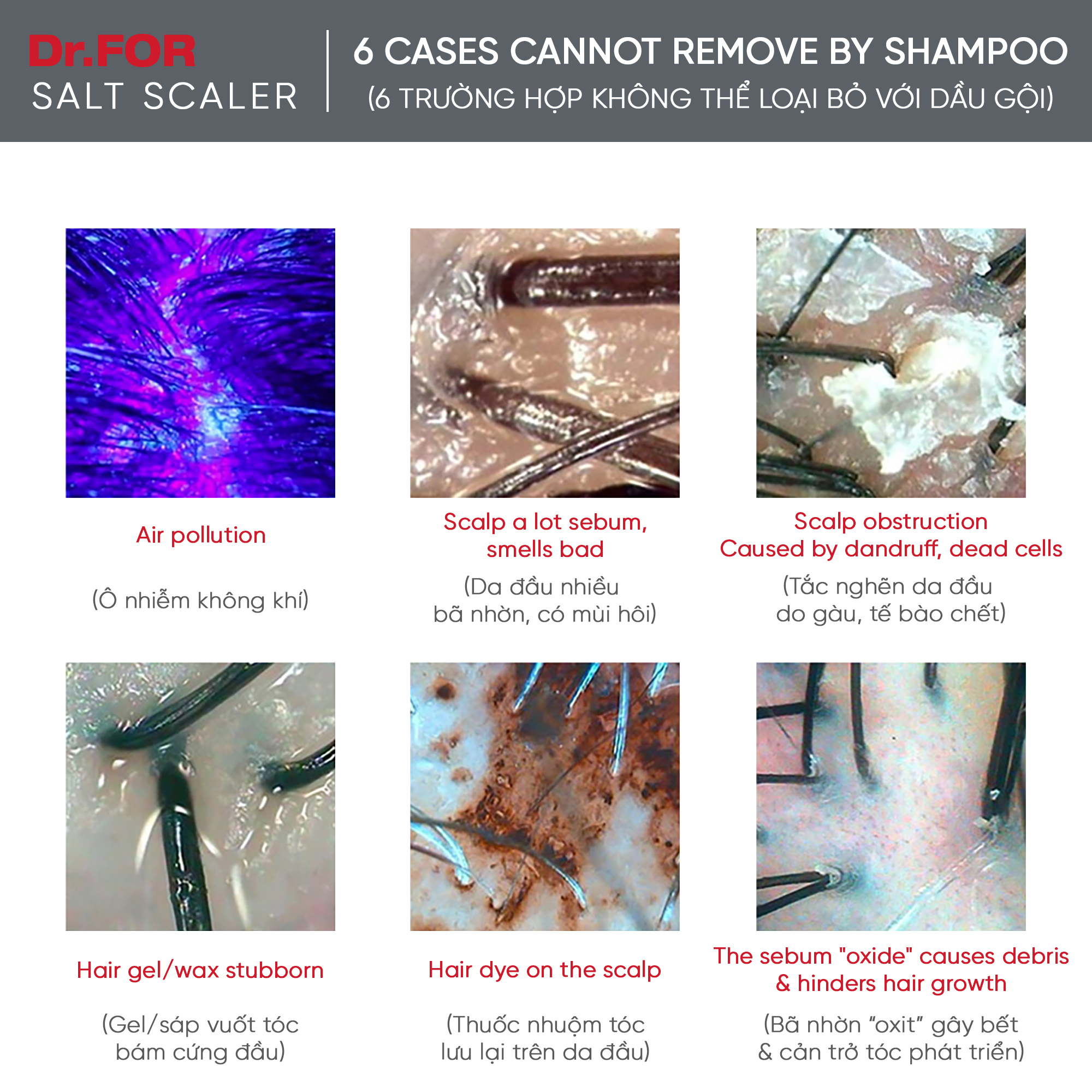 Tẩy tế bào chết da đầu chuyên sâu Dr.FORHAIR sạch gàu, ngăn ngừa bết tóc Dr For Hair Sea Salt Scaler 50g