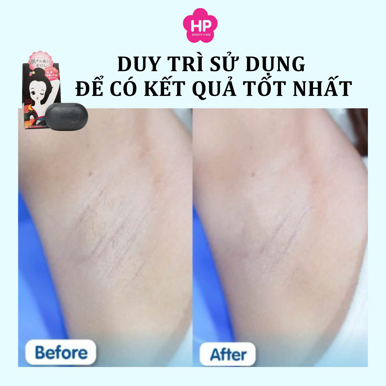 Pelican Phiên Bản Mini Xà Phòng Tắm Chống Thâm Nách Và Làm Sạch Cơ Thể 50g
