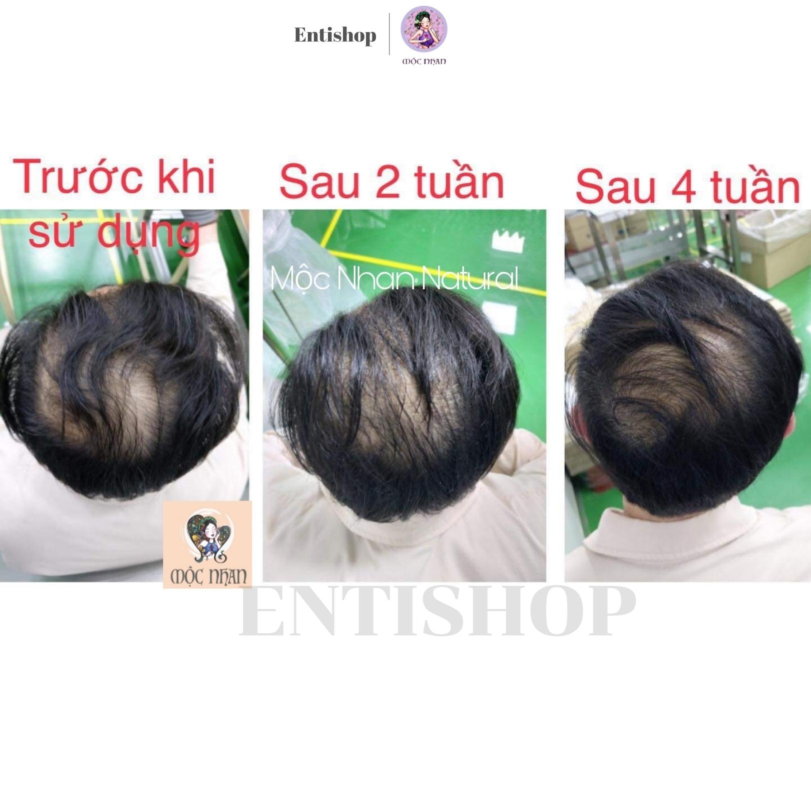 Dầu gội thảo dược bồ kết Ả đào hương cỏ cây Mộc Nhan ngăn rụng, dưỡng tóc chắc khỏe 500ml