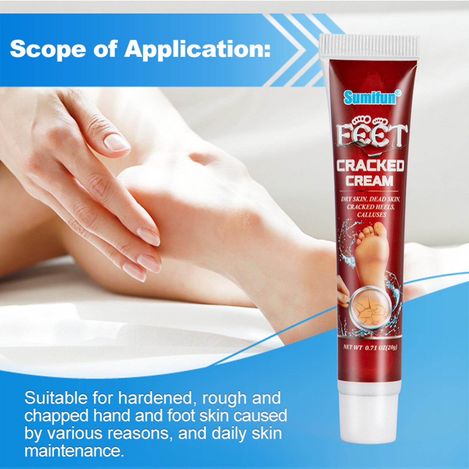 Chaps and Cracked Hands and Feet Cream Dry Crack Anti-Freeze Crack Turtle Cream