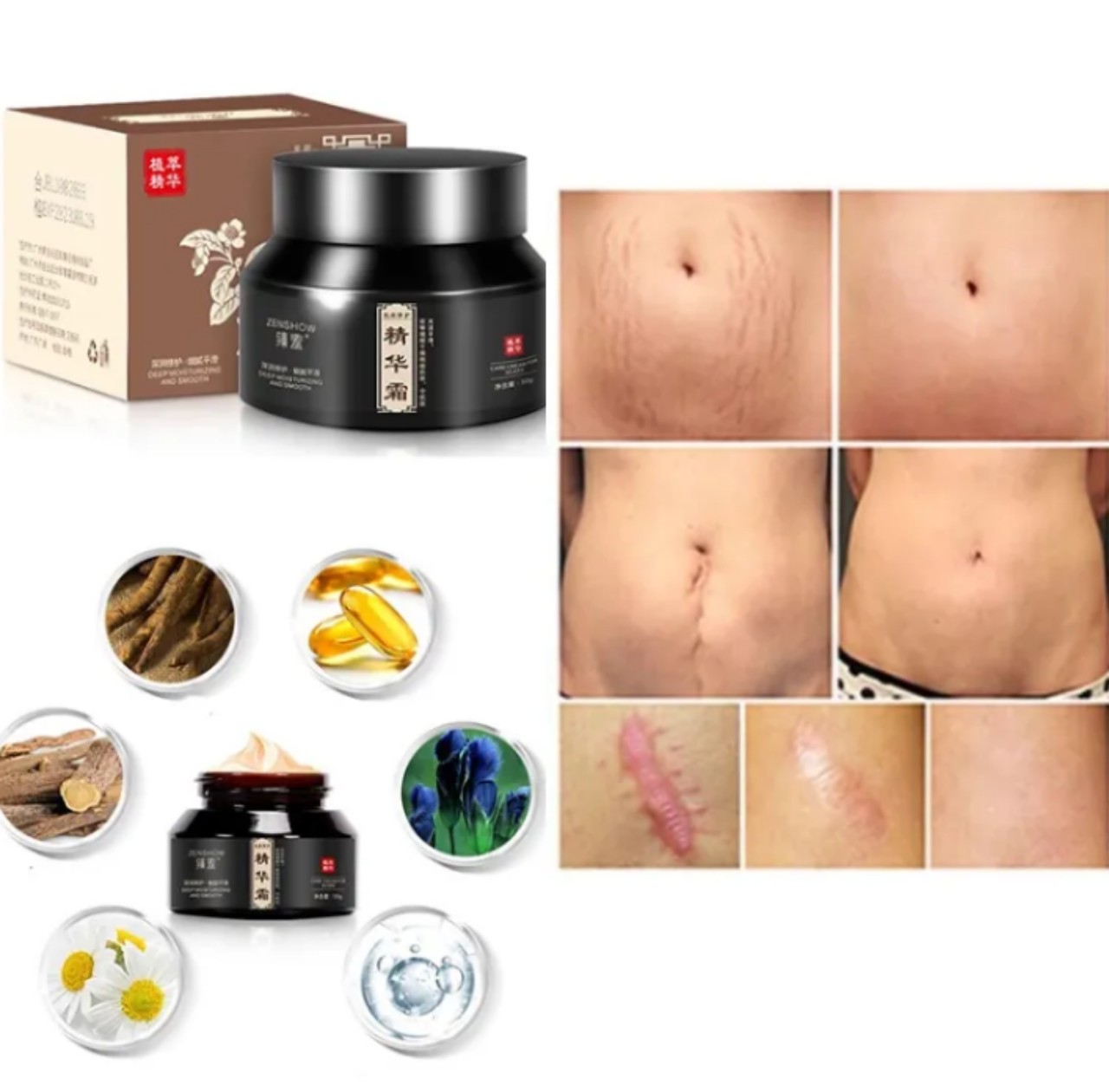 Kem xóa sẹo làm mờ sẹo hàng cao cấp