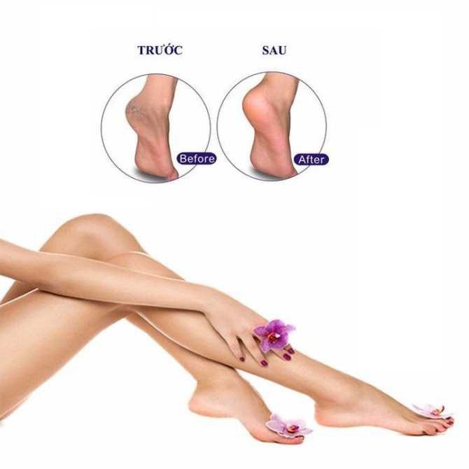 Dụng Cụ Chà Gót Chân Siêu Tốc 4in1