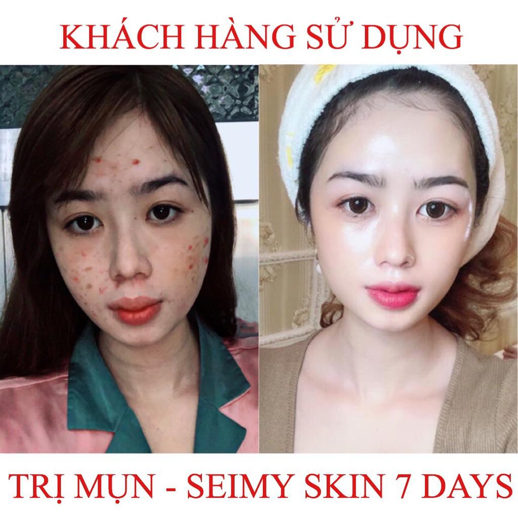 Serum ngừa mụn, giảm mụn thâm rỗ Seimy - Skin 7 Days - Công dụng 5 trong 1 hiệu quả sau 7 ngày