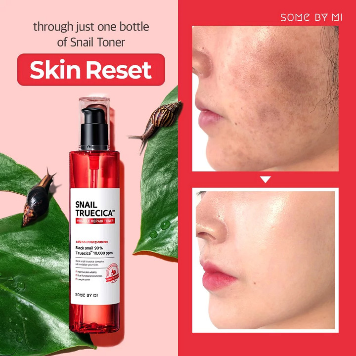 Nước Hoa Hồng Dưỡng Ẩm, Tái Tạo và Phục Hồi Da Some By Mi Snail Truecica Miracle Repair Toner 135ml