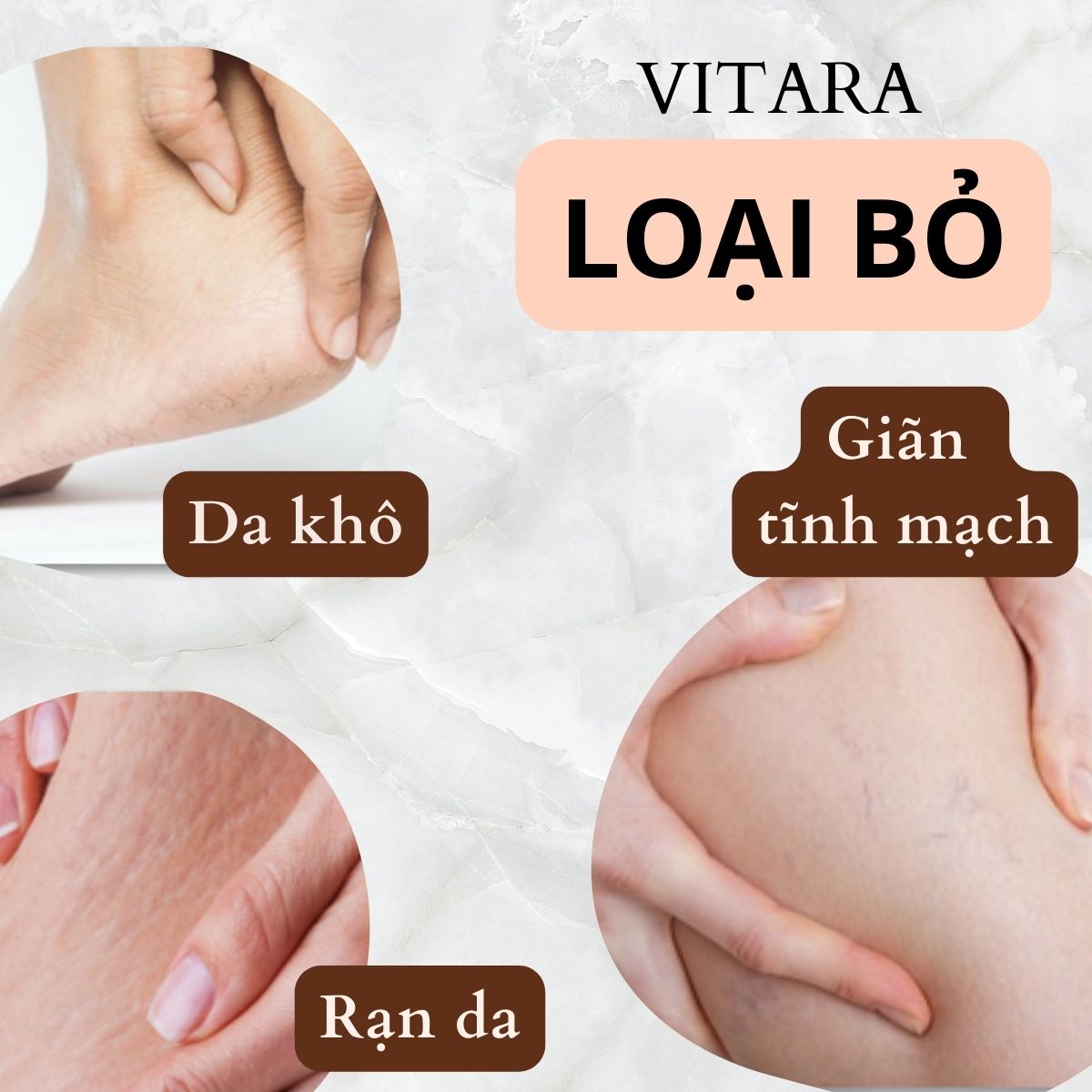 Kem thoa giãn tĩnh mạch Philosoft Legactif cải thiện chứng giãn tĩnh mạch, giảm sưng và dưỡng da 25g