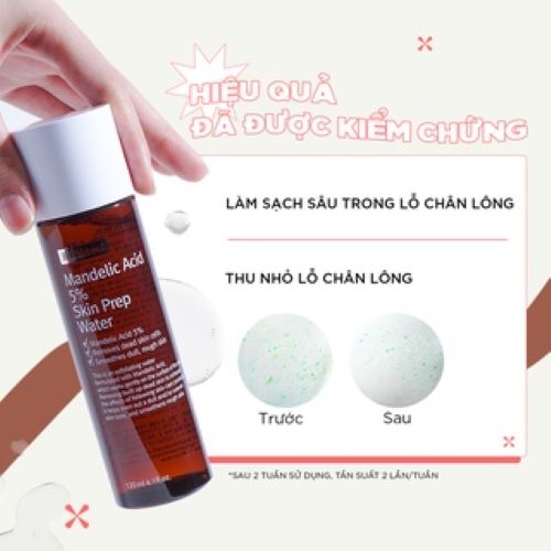 Nước hoa hồng BY WISHTREND MANDELIC ACID 5% SKIN PREP WATER 120ML