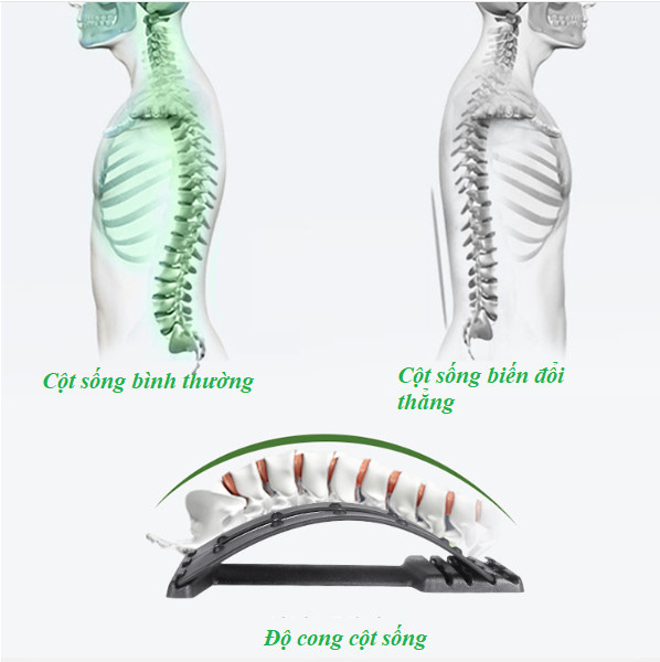 Khung Nắn Chỉnh Hình Cột Sống Lưng- Dụng Cụ Tập Hổ Trợ Sống Lưng Và Cột Sống, Thiết Bị Điều Trị Thoát Vị Đĩa Đệm, Thoái Hóa Cột Sống, Đau Lưng, Đau Thần Kinh Tọa, Đau Vai Gáy, Giao Màu Ngẫu Nhiên