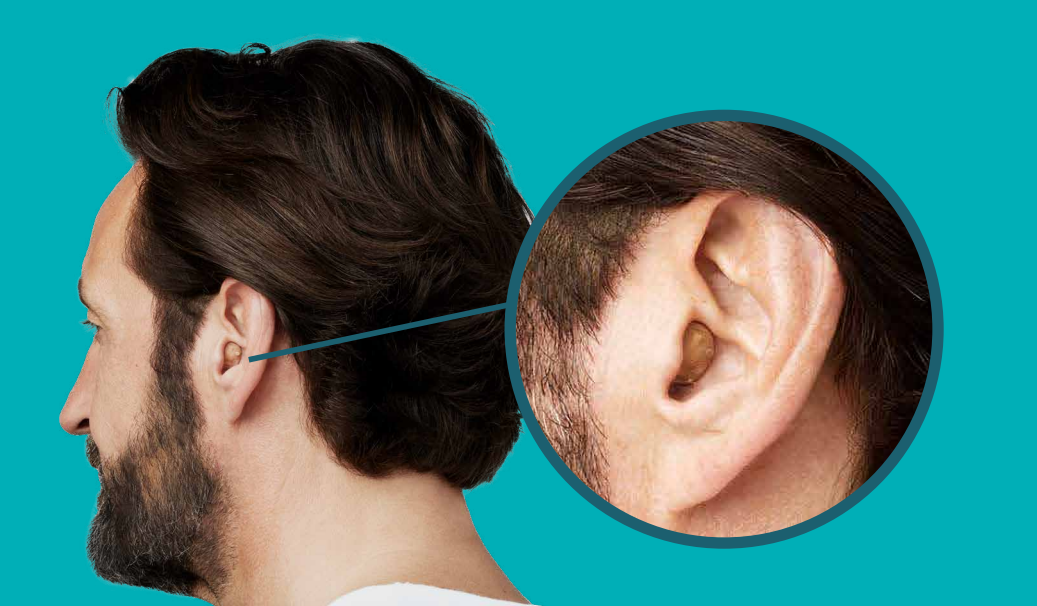 Máy trợ thính Vibe Nano 8 /Sivantos