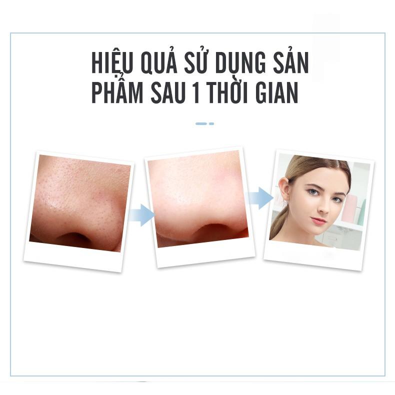 Máy Hút Mụn, Tẩy Tế Bào Chết K-SKIN KD8023 Sử Dụng Sóng Siêu Âm Giúp Thu Nhỏ Lỗ Chân Lông, Nâng Cơ - Hàng Chính Hãng