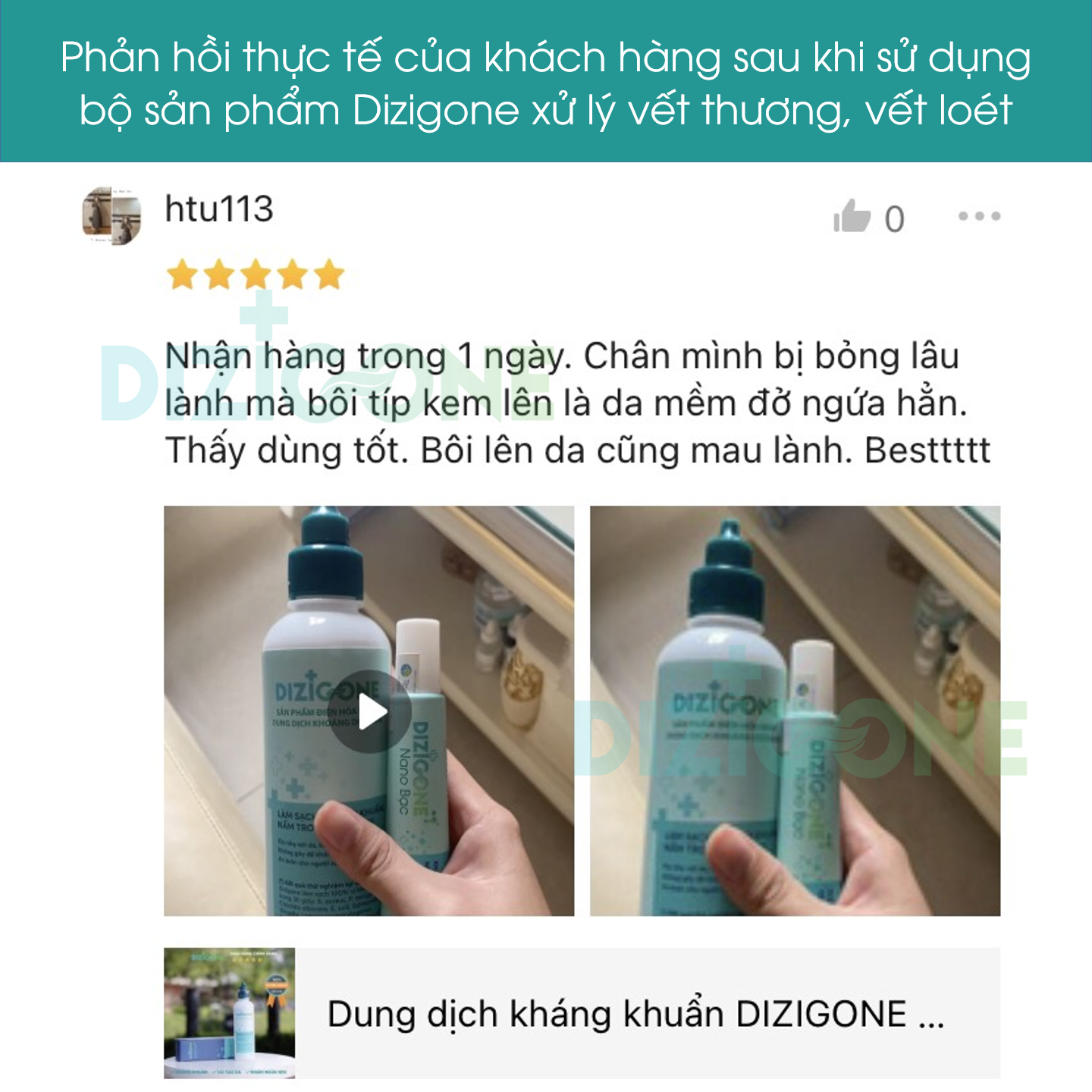 Dung dịch kháng khuẩn DIZIGONE chăm sóc tổn thương lành nhanh, không đau xót, tái tạo da, ngăn ngừa sẹo 300ml