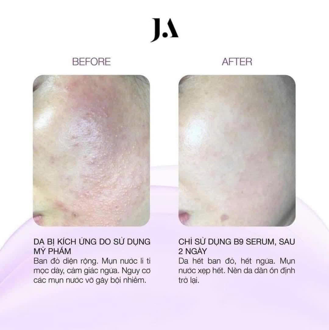Serum Giảm Kích Ứng Juliette Armand Folic Acid B9