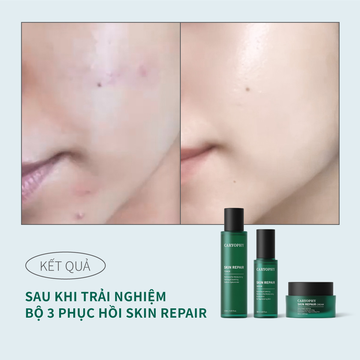 Nước Cân Bằng Cấp Nước và Làm Dịu Da - Caryophy Skin Repair Toner 120ml