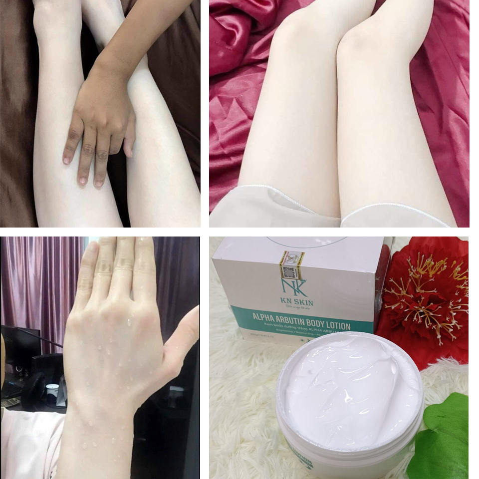 KEM BODY DƯỠNG TRẮNG DA ABUTIN KN SKIN Đường trắng da, giúp da đều màu, dưỡng ẩm da, cải thiện tình trạng da ngâm đen, dưỡng da mềm mịn, hỗ trợ phục hồi da.