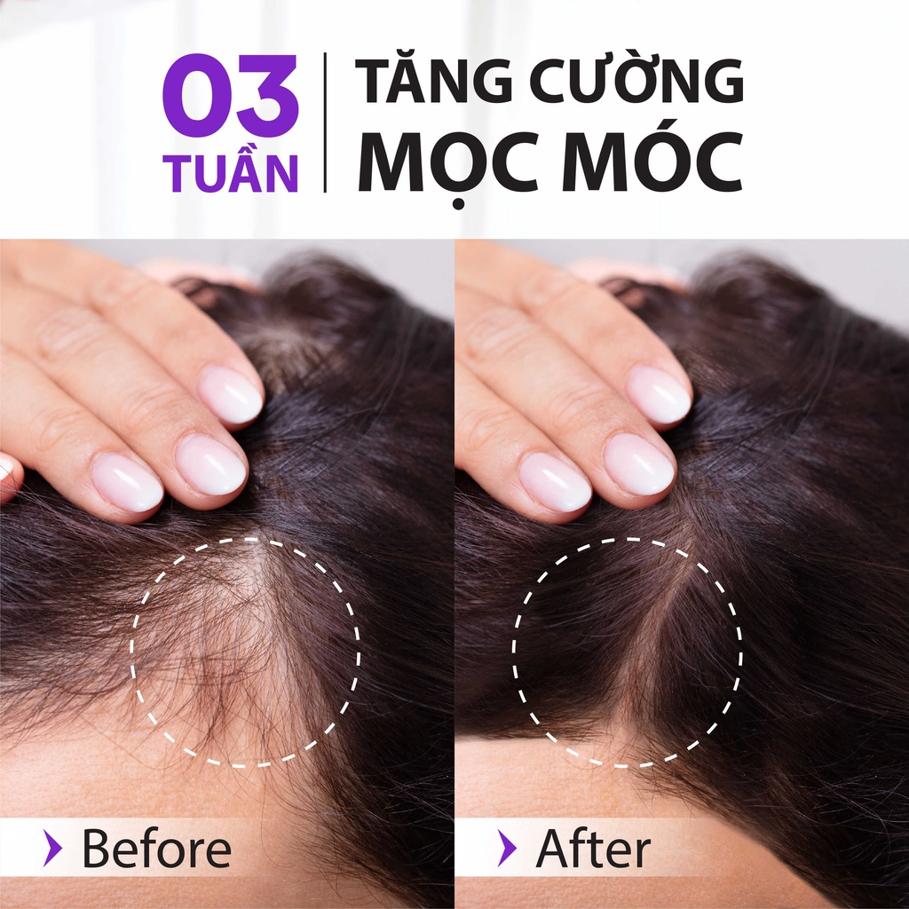 Serum Dưỡng tóc Biotin & Keratin Hỗ Trợ Phục Hồi, Bổ Sung Dưỡng Chất Mọc Tóc, Làm Dày Tóc MILAGANICS 30ml - 150ml