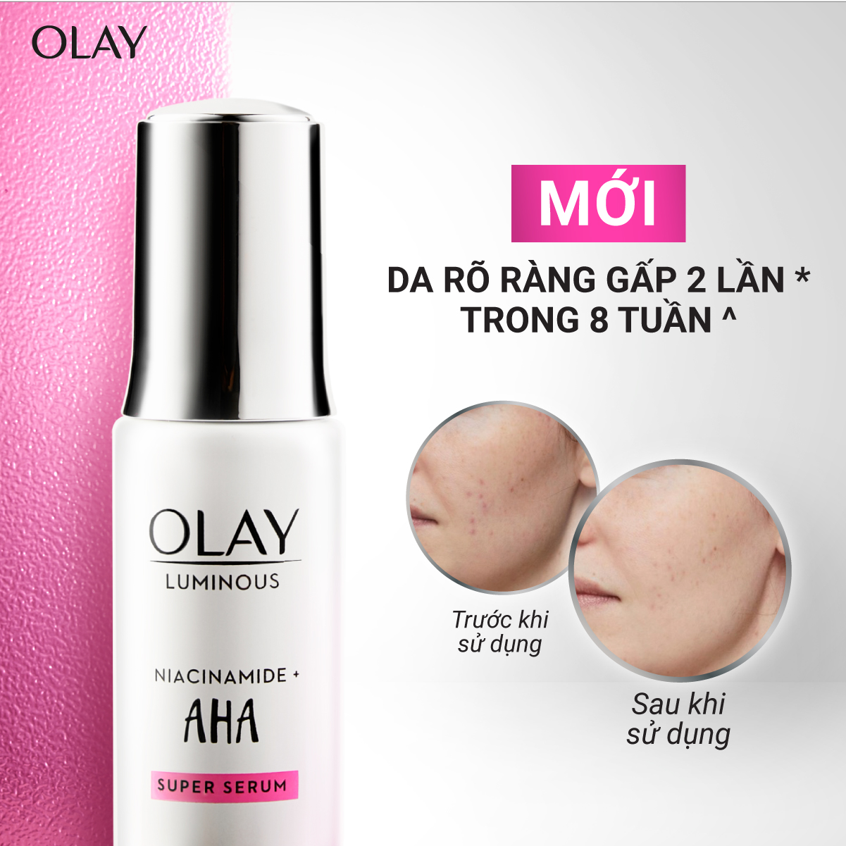 Siêu Tinh Chất Ngừa Lão Hóa OLAY Luminous Niacinamide Kết Hợp AHA 30ML