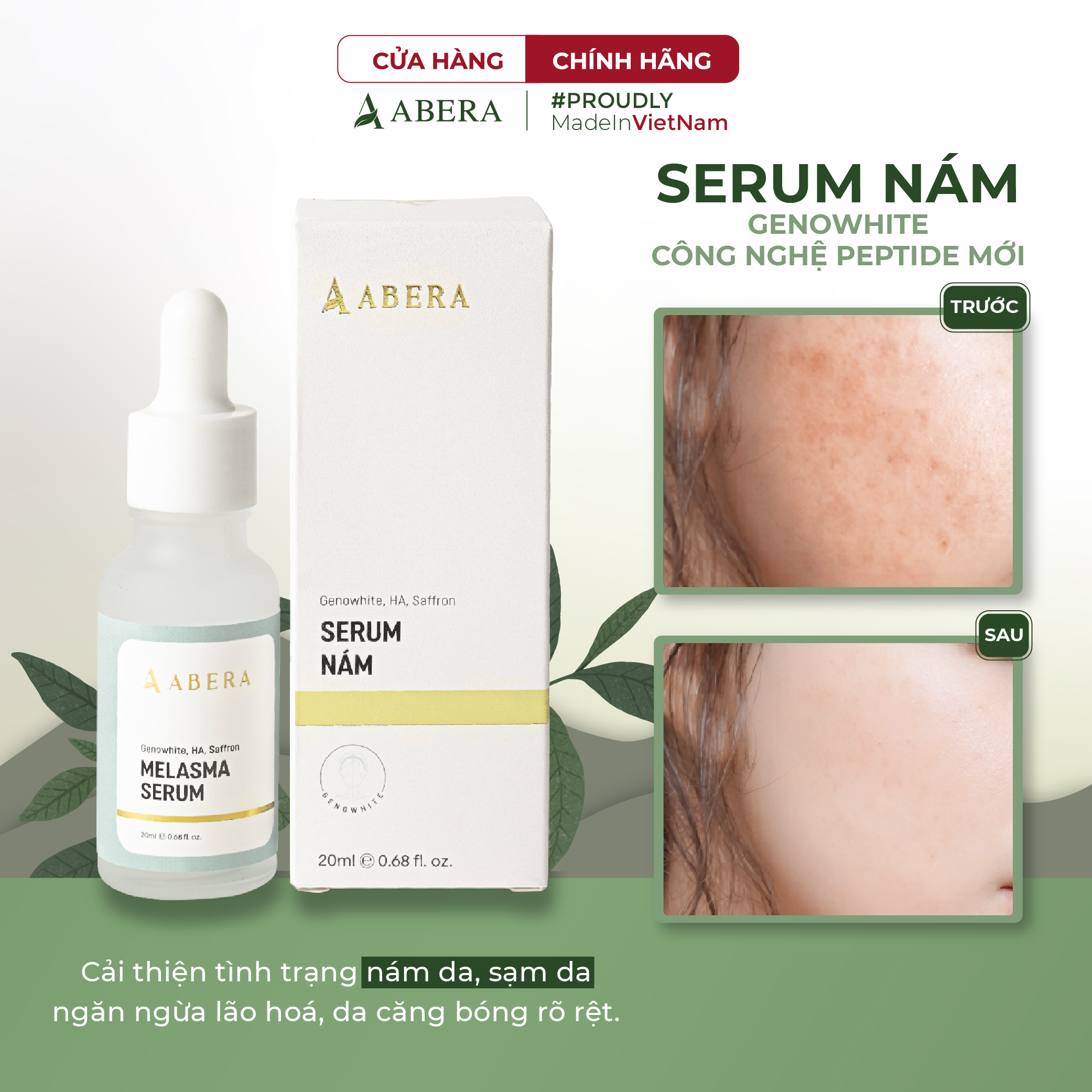 Serum Nám Da ABERA - Mờ Nám Hiệu Quả, Trắng Da Làn Da Sáng Mịn Không Tì Vết