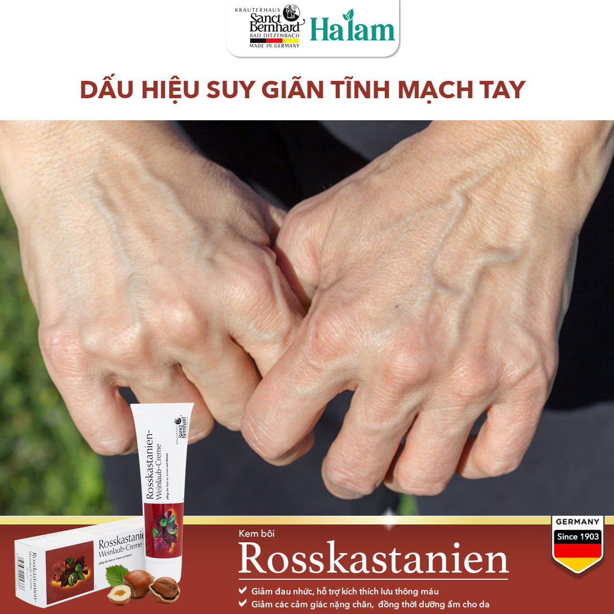 Kem bôi suy giãn tĩnh mạch Rosskastanien hạt dẻ ngựa giảm đau, tuần hoàn máu (tuýp 150ml)