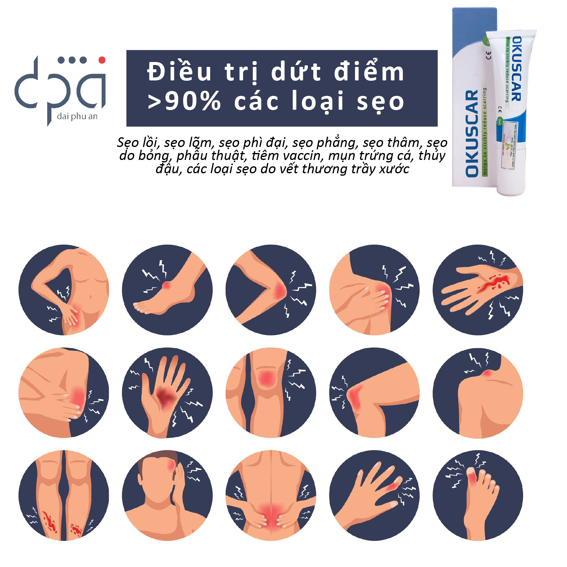 Combo 2 kem xóa sẹo cao cấp OKUSCAR - Thương hiệu 25 năm Hy Lạp - Thương hiệu số 1 Châu Âu - Được chuyên gia bác sĩ khuyên dùng