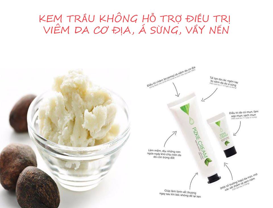 KEM TRẦU KHÔNG 30 GR - Hỗ trợ chữa các vấn đề về da: ngứa, nổi mề đay, chàm, á sừng , viêm da cơ địa