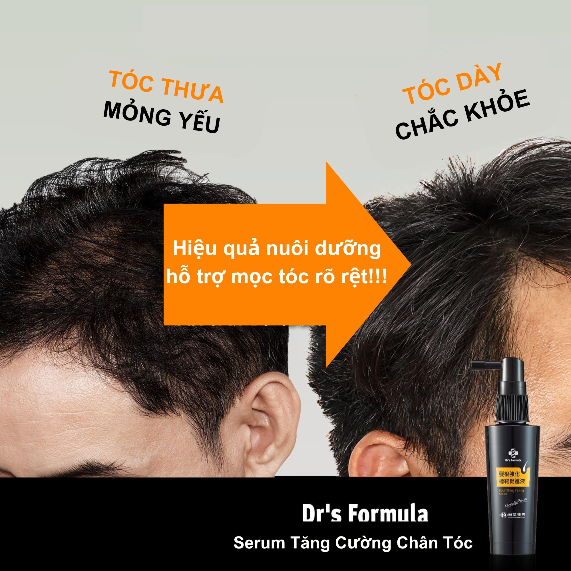 Serum tăng cường chân tóc hỗ trợ mọc tóc Dr's Formula Root-Strengthening 50ml+20ml