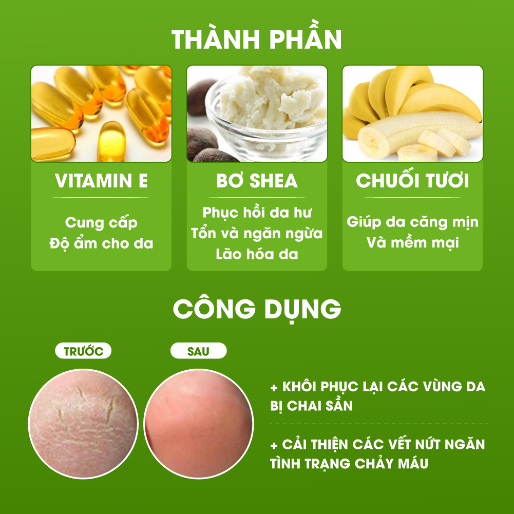 [72gr] Bộ 3 hũ kem nứt gót chân Banana Heel Cream | Hũ 24gr