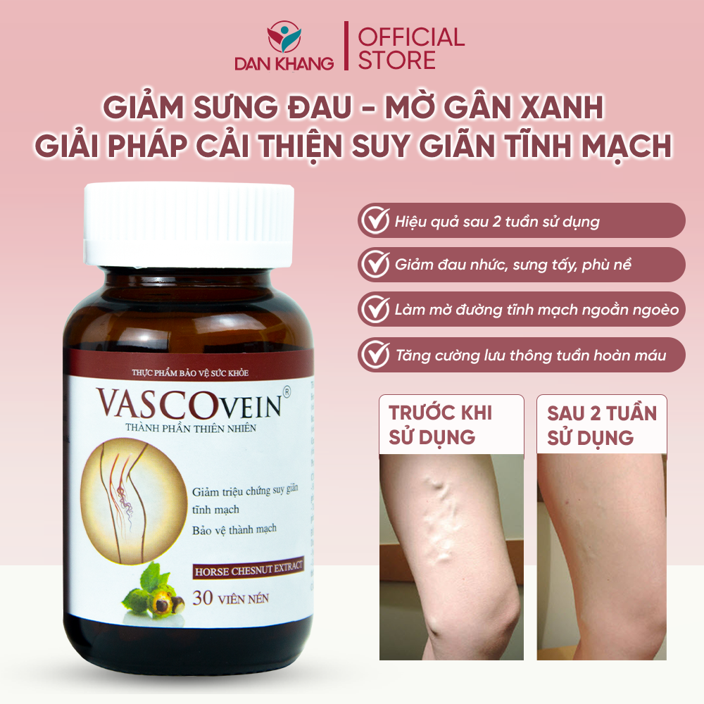 Liệu Trình Cải Thiện Suy Giãn Tĩnh Mạch Vascovein Giảm Đau Và Làm Mờ Gân Xanh Do Suy Giãn Tĩnh Mạch