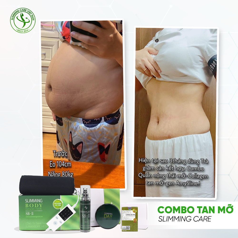 Bộ ủ nóng Slimming Body Sb2 đai điện cải tiến hỗ trợ làm thon gọn vòng eo