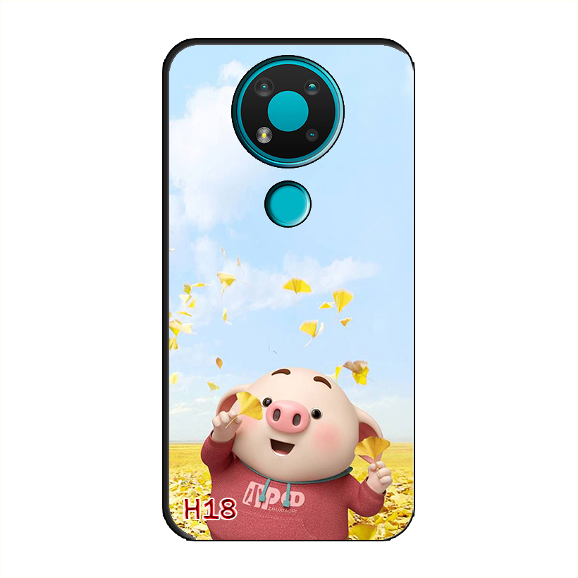 Ốp Dẻo Dành Cho NOKIA 3.4